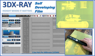 Self Developing Film Portable X-ray